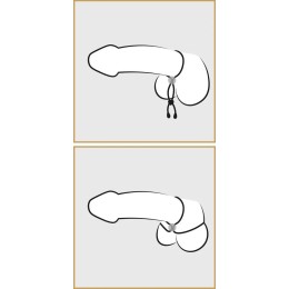 Лассо для пениса Double Cock Loop